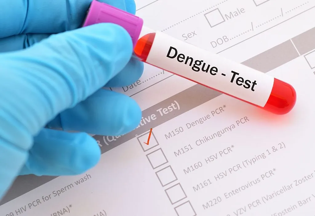 Diagnosis of Dengue