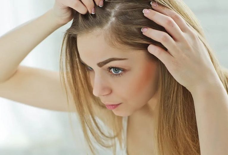 Head Lice During Pregnancy - Treatment & Preventive Measures