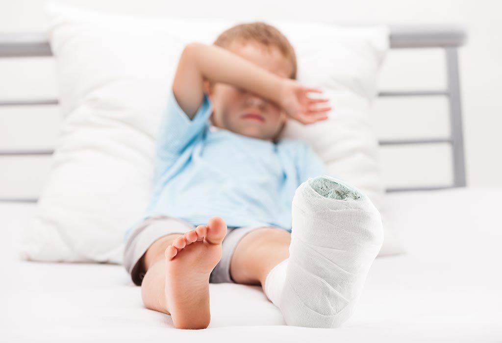 Fractures in Children – Types, Causes, Diagnosis and Treatment