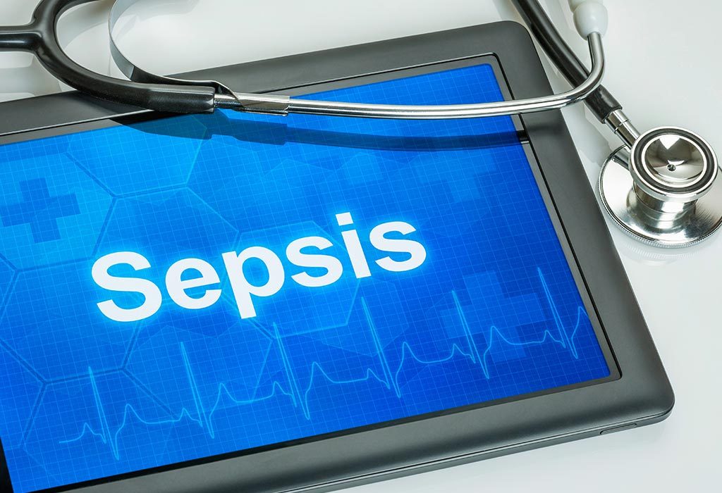 Sepsis When Pregnant – Causes, Symptoms, and Prevention