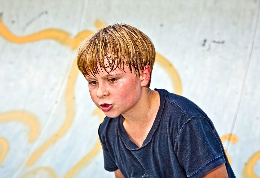Excessive Sweating in Children – Causes, Symptoms and Treatment