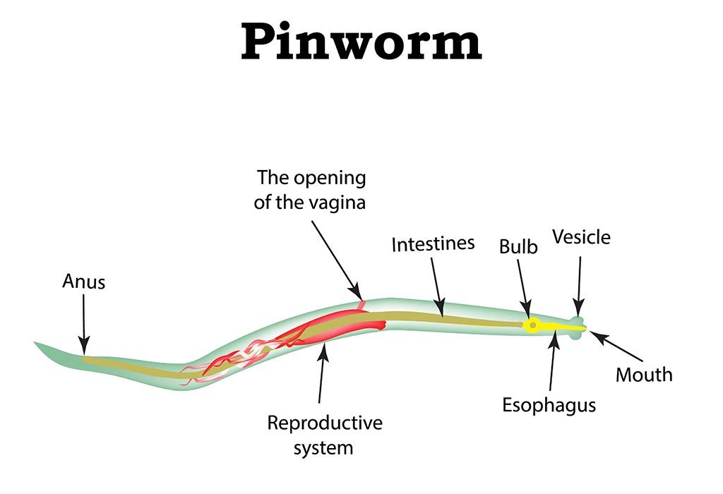 Pinworms On Anus