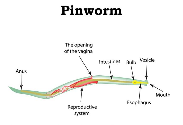 प्रेगनेंसी में पिनवर्म या थ्रेडवर्म इन्फेक्शन