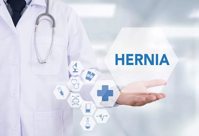Hernia after C Section Delivery - Causes, Symptoms, and Treatment