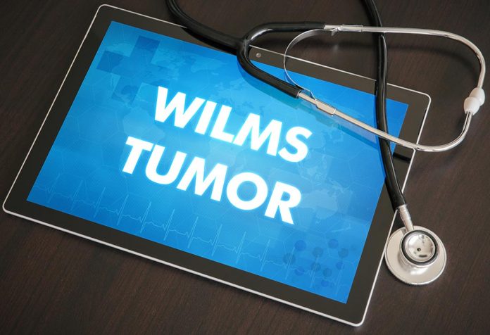 Wilms tumour in kids