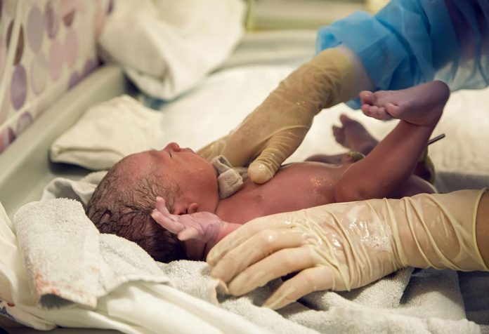 A doctor checking a newborn