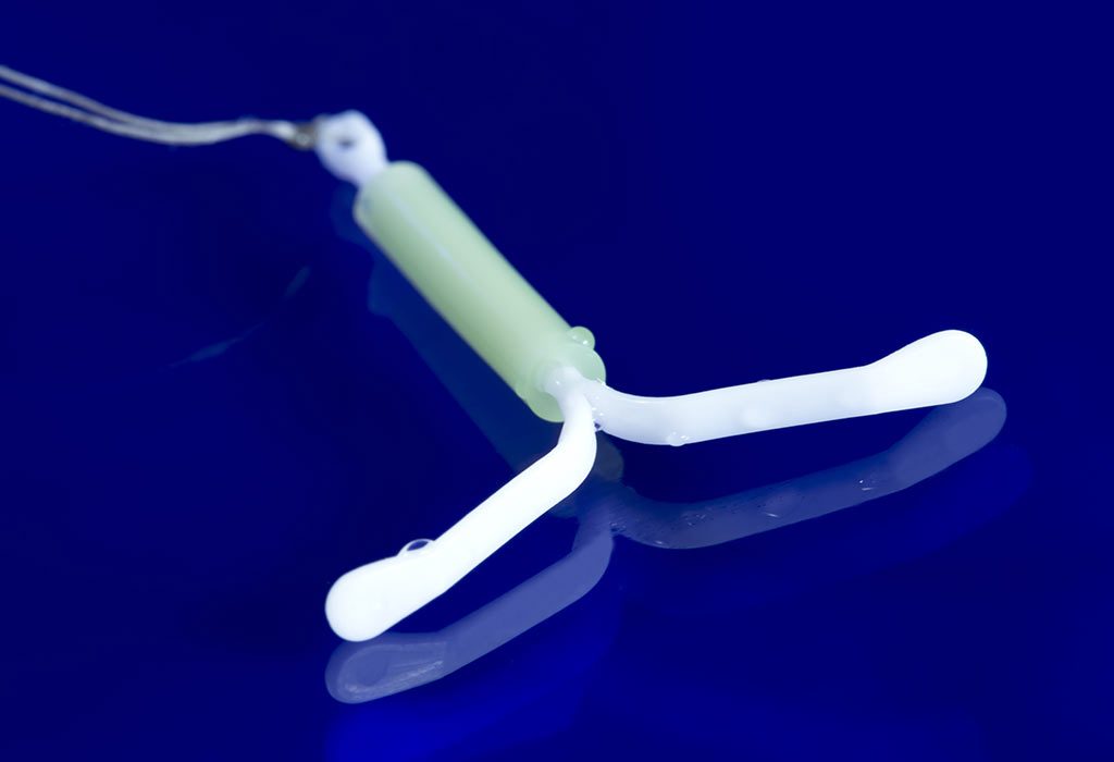 How Soon Can You Get Pregnant After IUD Removal?