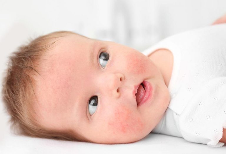 Wheat Allergy in Babies - Signs and Tips to Handle It