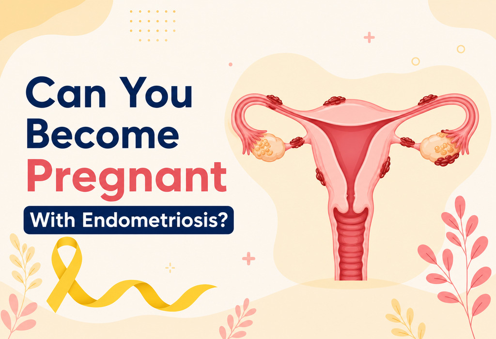 How to Get Pregnant With Endometriosis?