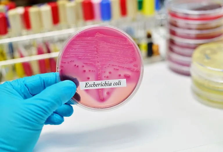 E. Coli Infection in Children
