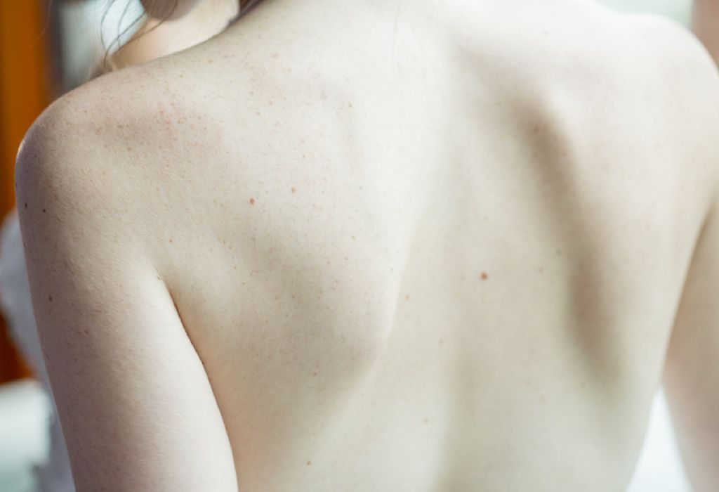 6 Skin Cancer Facts You Really Cannot Ignore