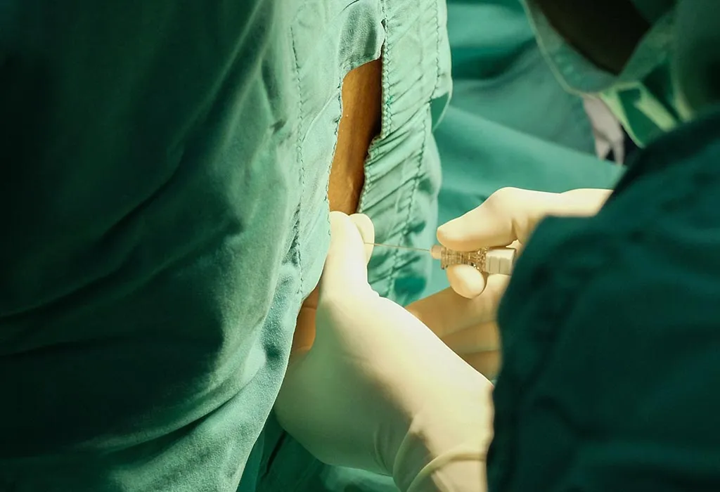 Getting Lumbar Puncture (Spinal Tap) in Pregnancy Getting Lumbar Puncture (Spinal Tap) in Pregnancy