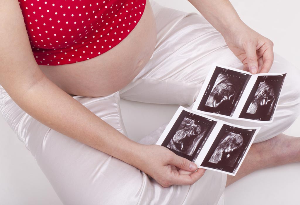 जुळ्या किंवा एकाधिक बाळांसह गरोदरपण - ३३ वा आठवडा - अल्ट्रासाऊंड
