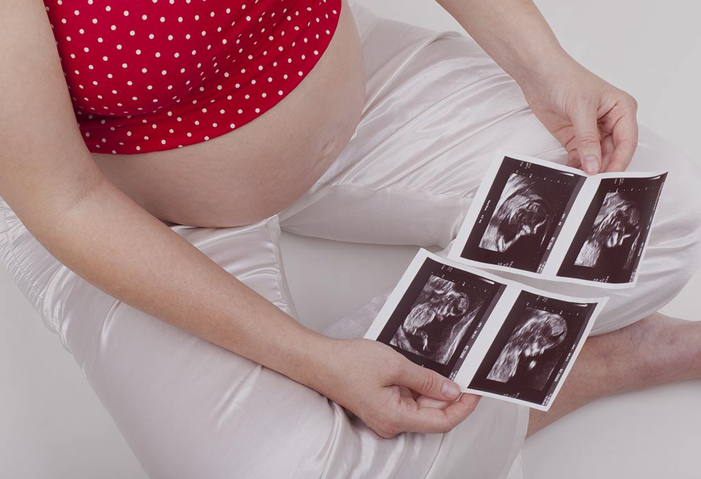 Twin Pregnancy Week Symptoms Baby Size Ultrasound More