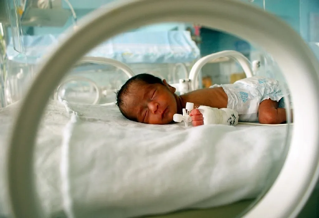 How to Cure Jaundice in Newborn Baby