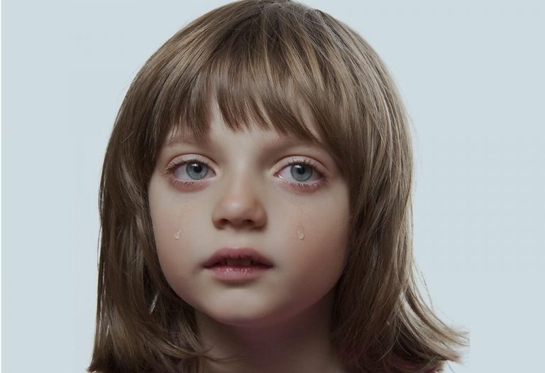 Watery Eyes (Epiphora) in Kids - Causes, Symptoms & Treatment