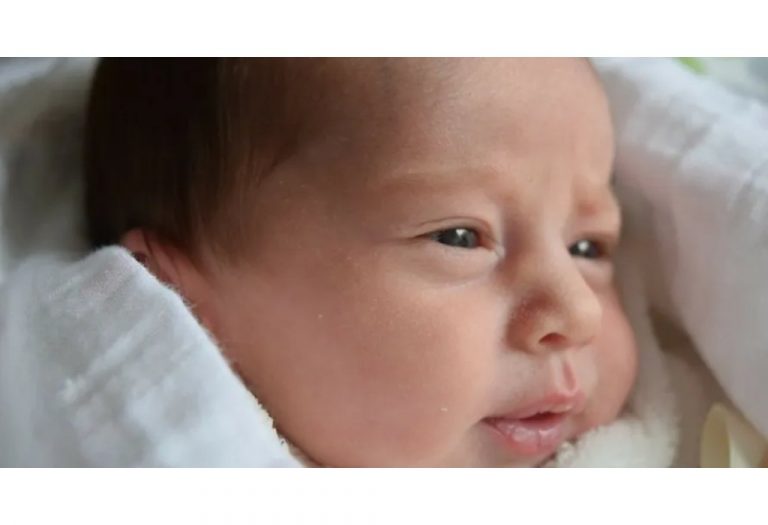Baby Skin Rashes & Conditions - Types & Treatment