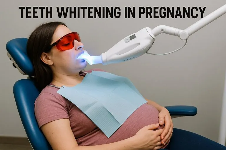 Teeth Whitening in Pregnancy – Is It Safe?