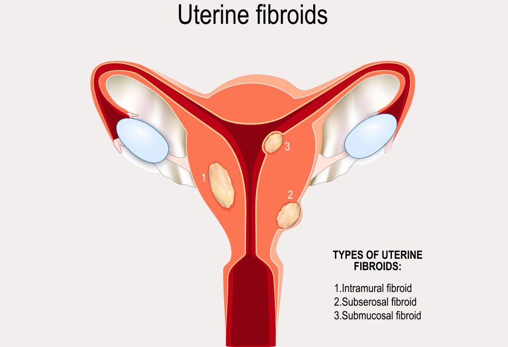 Brown Discharge After 10 Days Of Period 2024