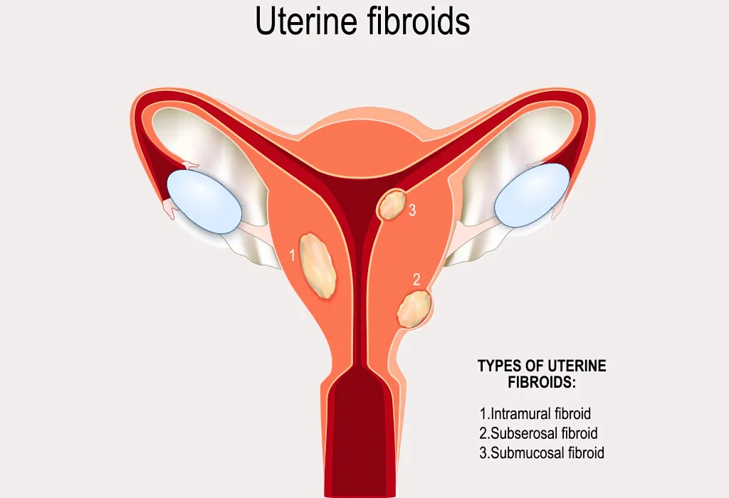 endometrium lining discharge