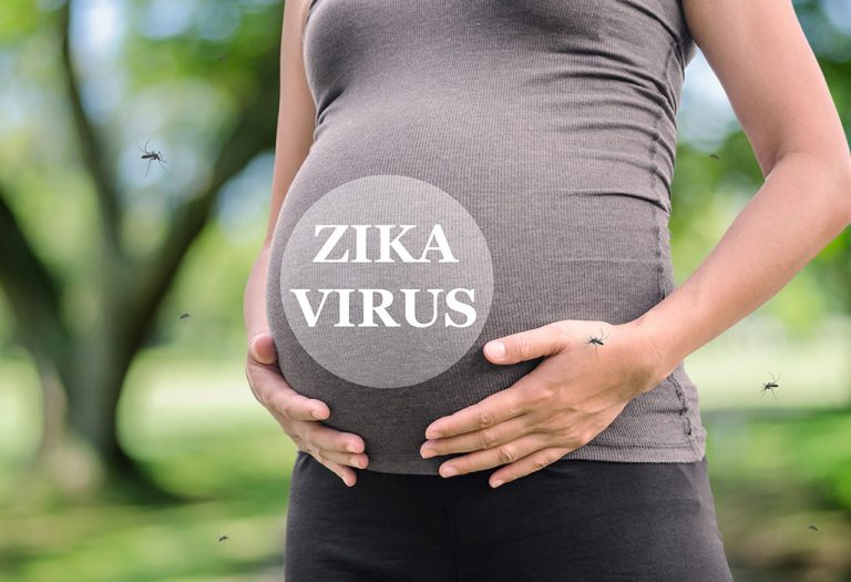 Zika Virus in Pregnancy