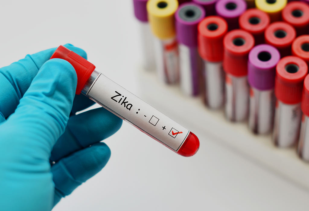 Zika test declared positive