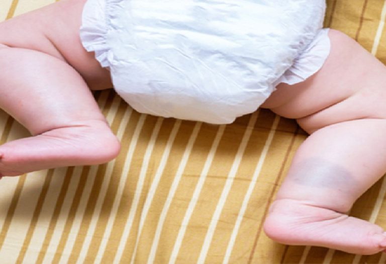 Leg Development in your Newborn