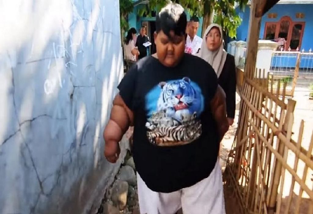 This 10-Year-Old Boy Weighs 190 Kg Due To One Unhealthy Eating Habit! Parents, We Must Be Warned…