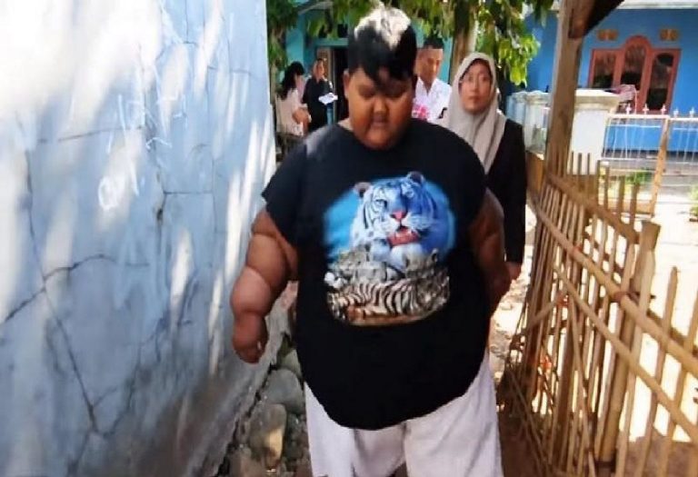 This 10-Year-Old Boy Weighs 190 Kg Due To One Unhealthy Eating Habit! Parents, We Must Be Warned...