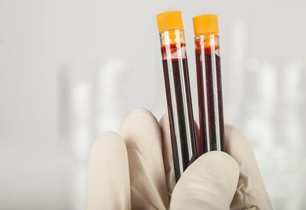 Genetic Testing Before Pregnancy: Types, Benefits, and What to Expect