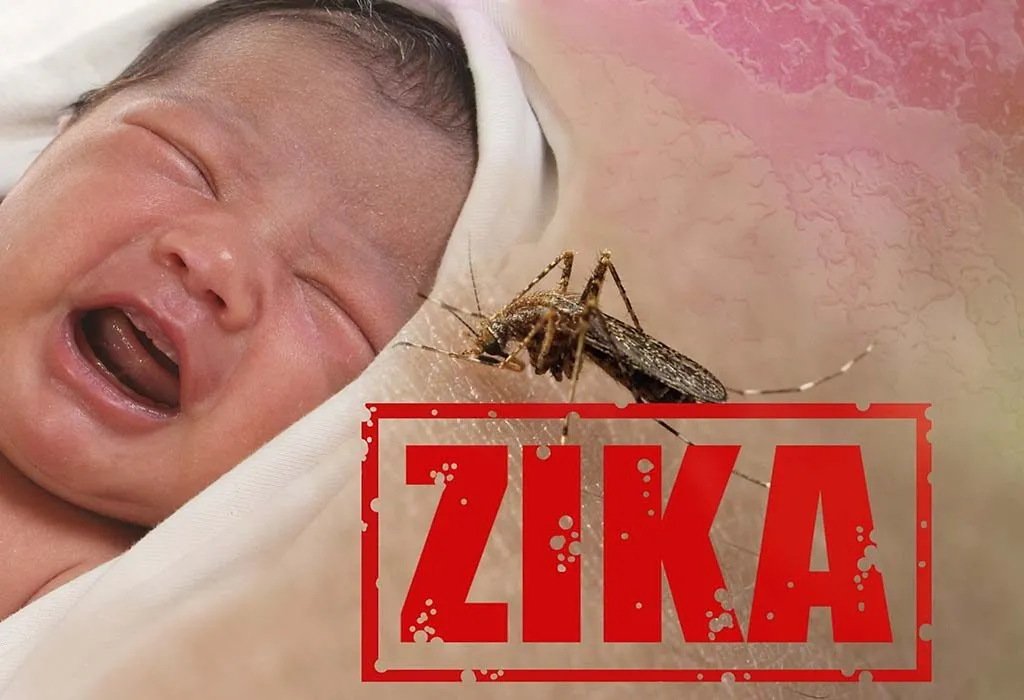 Zika Virus Infection in Children