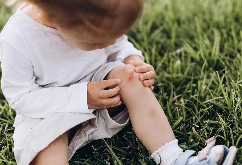 Common Causes of Childhood Injuries and their Prevention