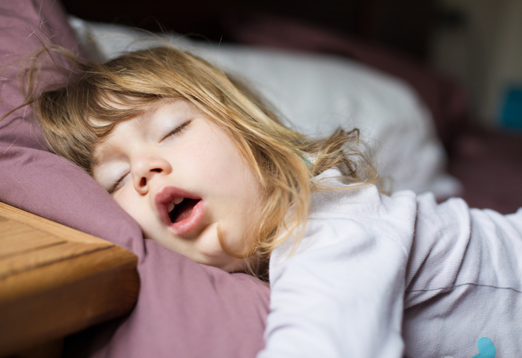 Girl with apnea sleeping with mouth open