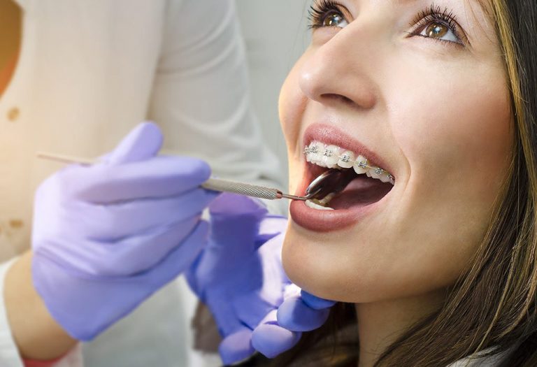 Can You Get Braces While Pregnant?
