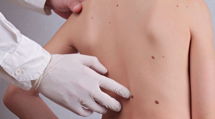 19 week old baby fussy