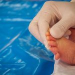 Baby Born With Extra Fingers and Toes (Polydactyly)