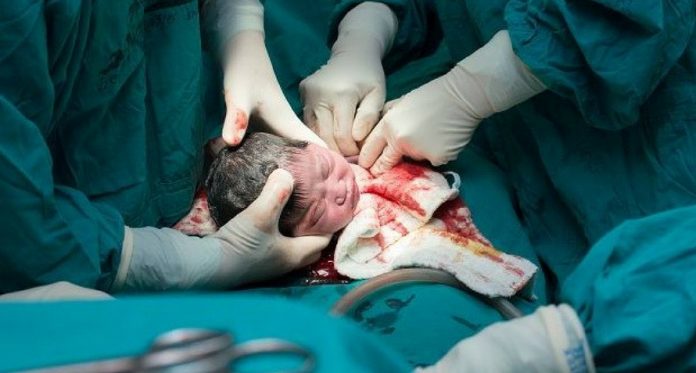 moms viral post slams anyone who thinks c sections are the easy way out