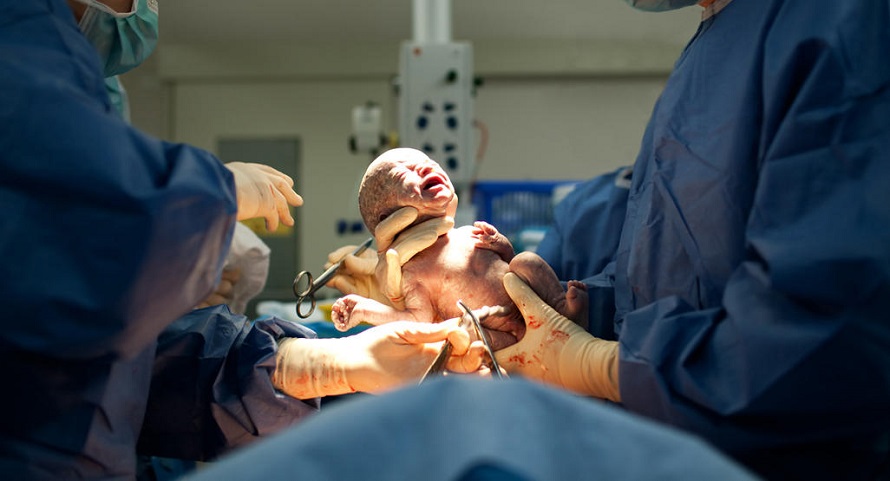 New Research Has Revealed a Distressing Fact About Babies Born Via C-Section