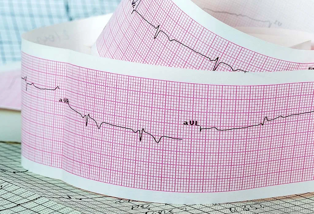 Problems With Heart Rhythm