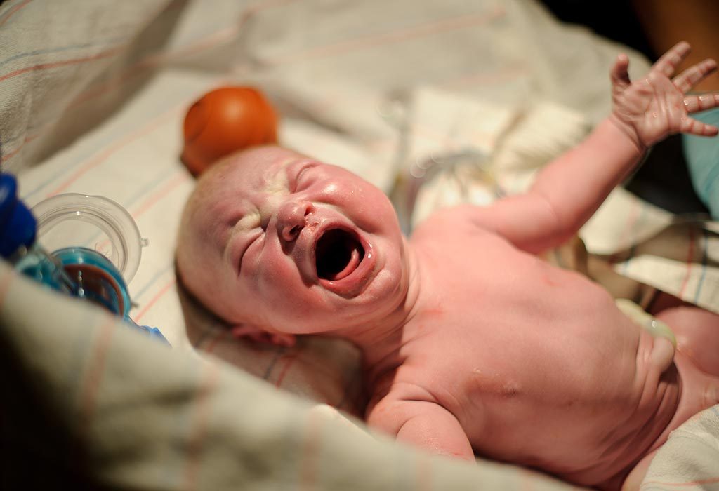 baby not crying at birth