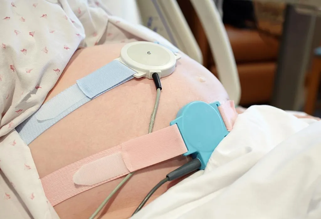 Electronic Foetal Monitoring