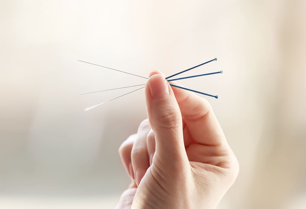 Make sure the acupuncture needles are properly sterilised