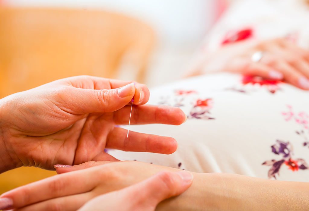 Acupuncture to Induce Labour – Is It Right for You?