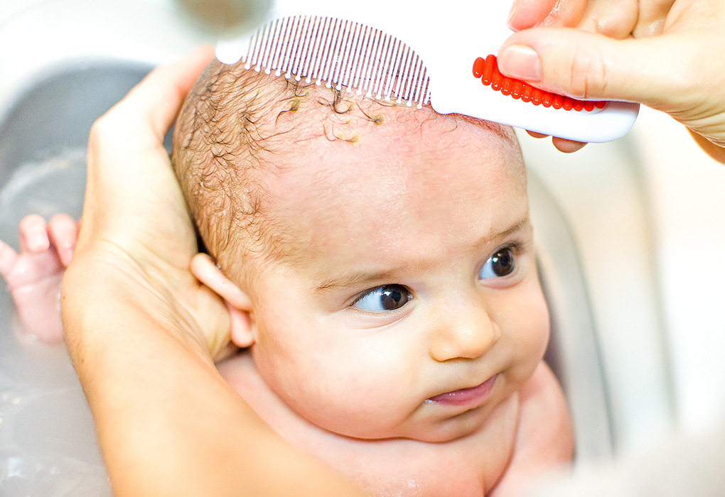 बाळाला क्रॅडल कॅप स्केल ही समस्या असल्यास त्वचेचे खवले सैल करण्यास मदत होते