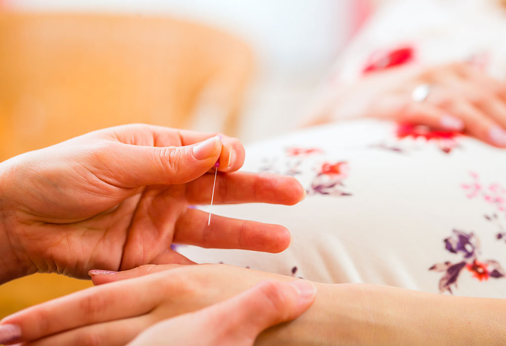 Acupuncture for Inducing Labour