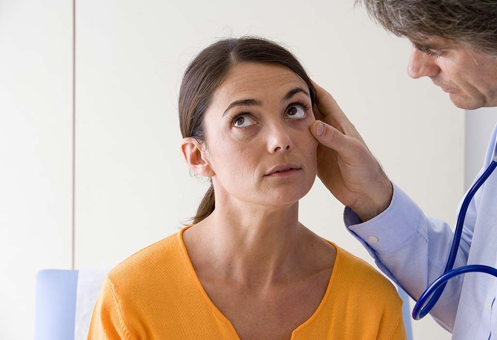 A doctor checking a woman for the signs of anaemia