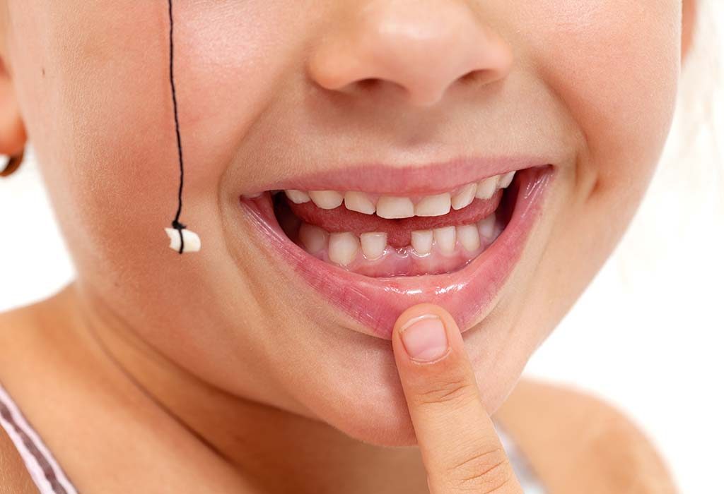 6 Ways To Remove Loose Baby Tooth Without Pain At Home