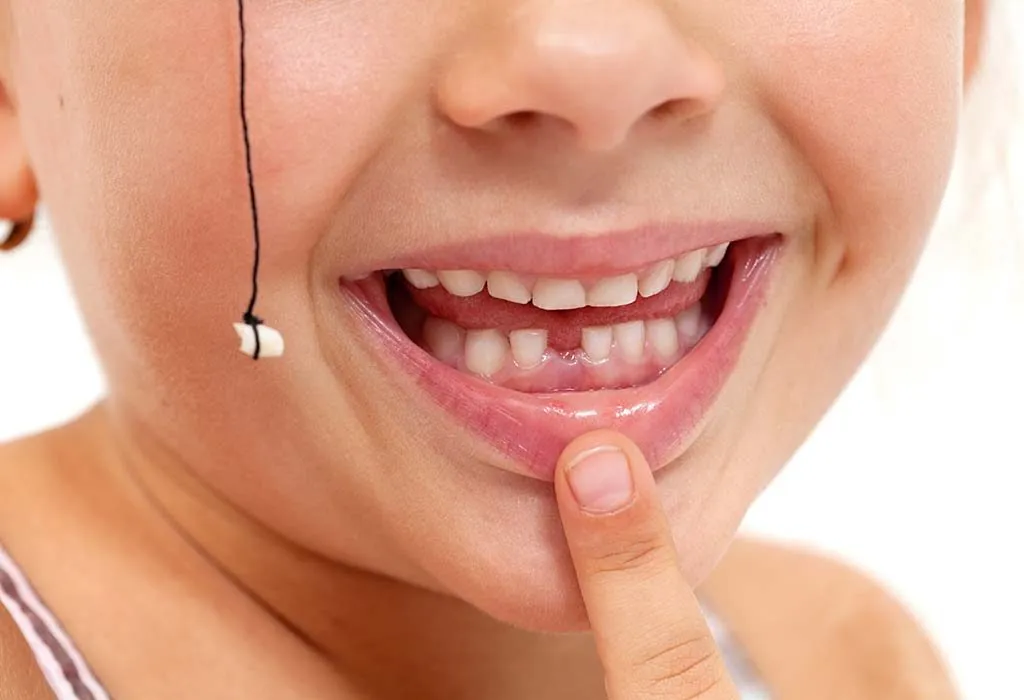 6 Ways To Remove Loose Baby Tooth Without Pain At Home