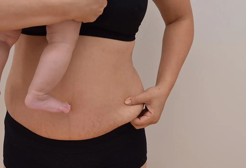 Effective Ways to Lose Weight and Stay Fit After Delivery Effective Ways to Lose Weight and Stay Fit After Delivery