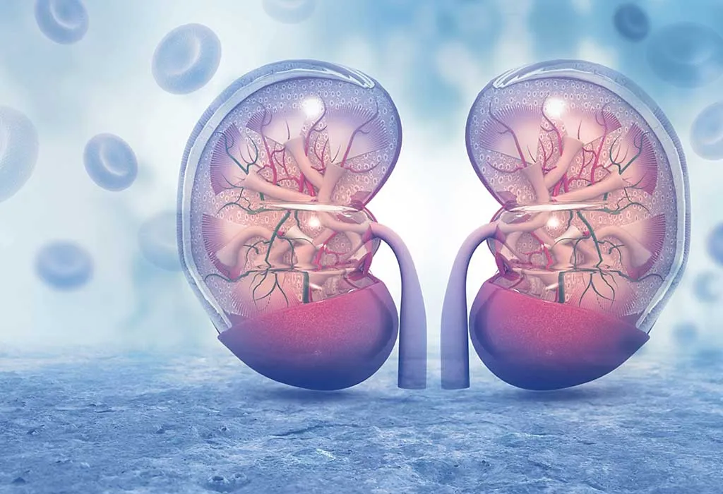 Kidney Stones
